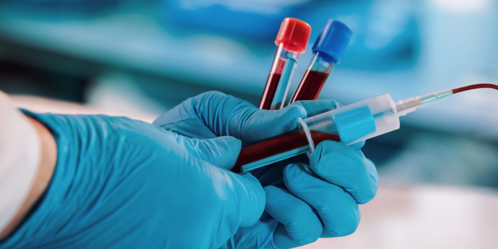 hands of a doctor taking samples of blood