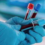 hands of a doctor taking samples of blood